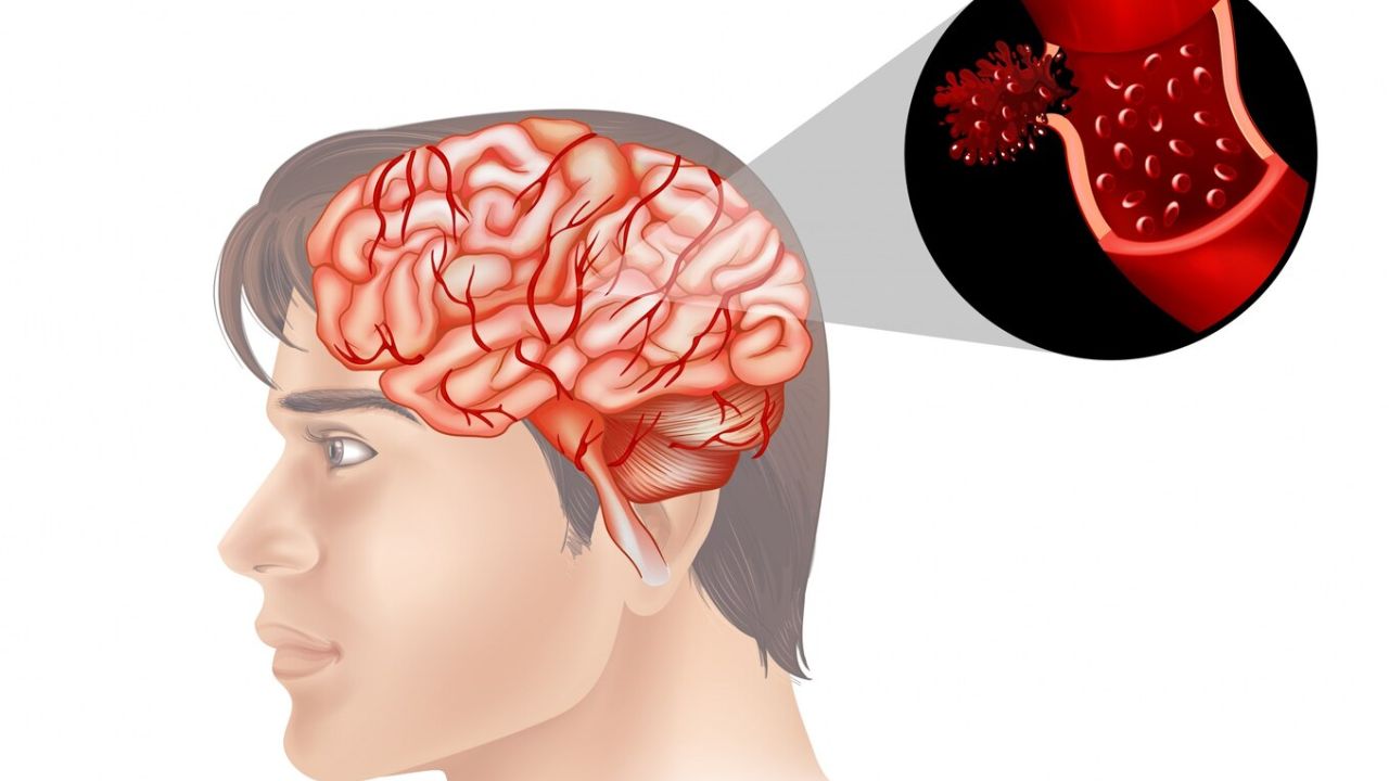 DoctorHub360.com Neurological Diseases